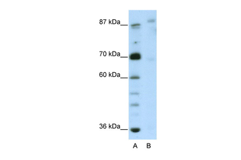 GLIS3 Rabbit Polyclonal Antibody
