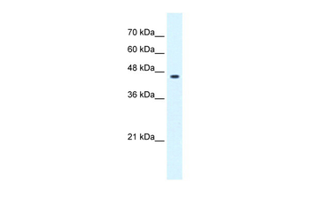 GLIS3 Rabbit Polyclonal Antibody