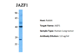 JAZF1 Rabbit Polyclonal Antibody