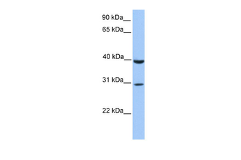 JAZF1 Rabbit Polyclonal Antibody