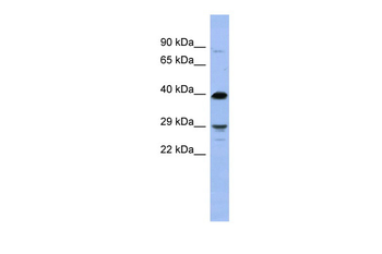 OLIG3 Rabbit Polyclonal Antibody
