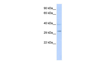 SIRT5 Rabbit Polyclonal Antibody