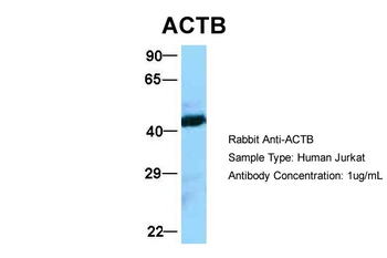 ACTB Rabbit Polyclonal Antibody