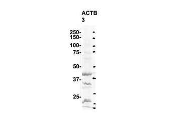 ACTB Rabbit Polyclonal Antibody