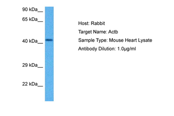 ACTB Rabbit Polyclonal Antibody