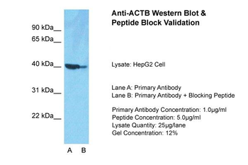 ACTB Rabbit Polyclonal Antibody