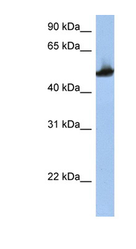 TUBB2A Rabbit Polyclonal Antibody