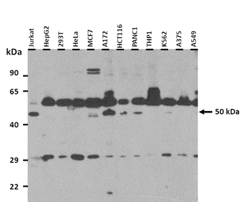 TUBA4A Rabbit Polyclonal Antibody