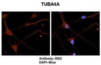 TUBA4A Rabbit Polyclonal Antibody