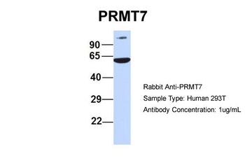 PRMT7 Rabbit Polyclonal Antibody