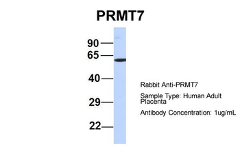 PRMT7 Rabbit Polyclonal Antibody