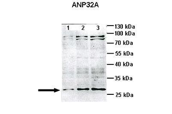 ANP32A Rabbit Polyclonal Antibody