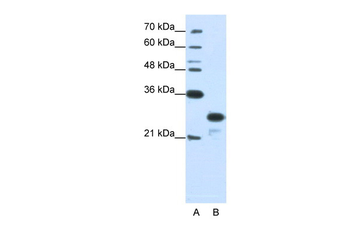 ANP32A Rabbit Polyclonal Antibody