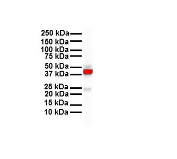 KRT18 Rabbit Polyclonal Antibody