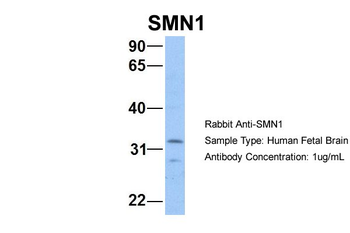 SMN1 Rabbit Polyclonal Antibody