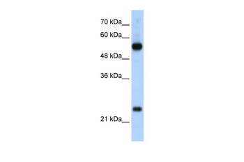 RPL13 Rabbit Polyclonal Antibody