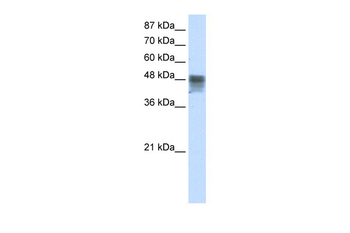 RBMS3 Rabbit Polyclonal Antibody