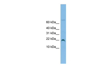 SNU13 Rabbit Polyclonal Antibody