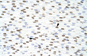 HNRPD Rabbit Polyclonal Antibody