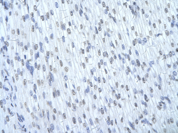 HNRPD Rabbit Polyclonal Antibody