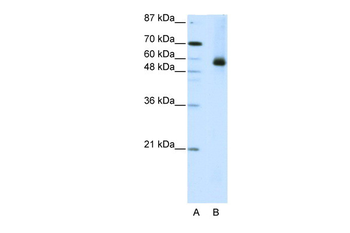 HNRPL Rabbit Polyclonal Antibody