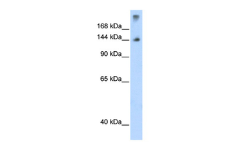 SF3B1 Rabbit Polyclonal Antibody