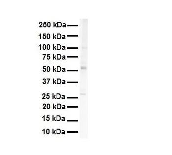 SNRP70 Rabbit Polyclonal Antibody