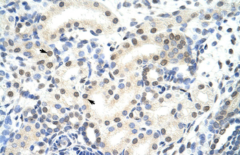 SNRP70 Rabbit Polyclonal Antibody