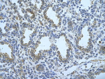 FUS Rabbit Polyclonal Antibody