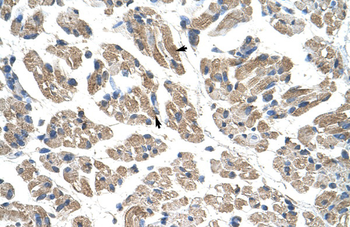 GTPBP9 Rabbit Polyclonal Antibody
