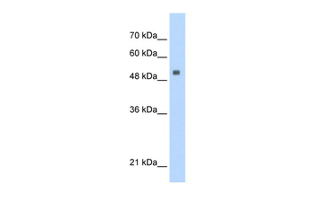 SERBP1 Rabbit Polyclonal Antibody