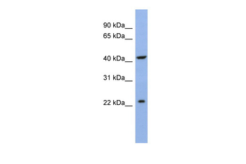 SLC35F1 Rabbit Polyclonal Antibody