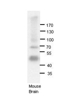 ADARB1 Rabbit Polyclonal Antibody