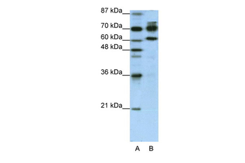 ADARB1 Rabbit Polyclonal Antibody