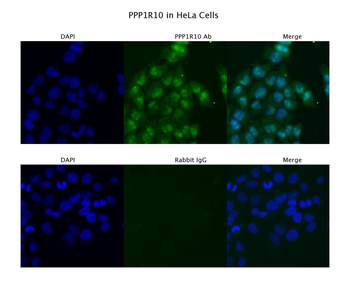PPP1R10 Rabbit Polyclonal Antibody