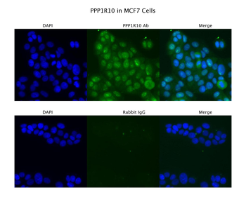 PPP1R10 Rabbit Polyclonal Antibody