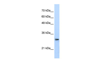 PSMA1 Rabbit Polyclonal Antibody