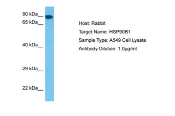 HSP90B1 Rabbit Polyclonal Antibody