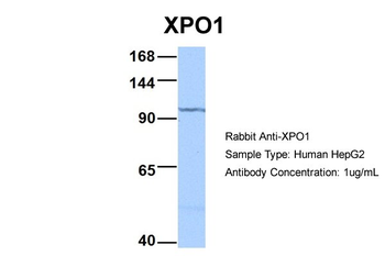 XPO1 Rabbit Polyclonal Antibody
