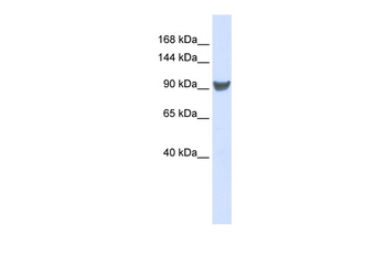 XPO1 Rabbit Polyclonal Antibody