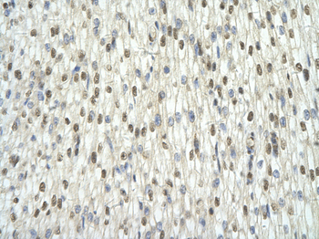 TAF15 Rabbit Polyclonal Antibody