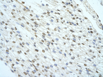 KHSRP Rabbit Polyclonal Antibody