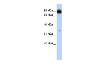 PRKRA Rabbit Polyclonal Antibody