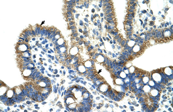 CPNE1 Rabbit Polyclonal Antibody
