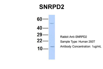 SNRPD2 Rabbit Polyclonal Antibody