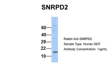 SNRPD2 Rabbit Polyclonal Antibody