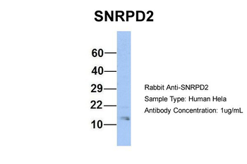 SNRPD2 Rabbit Polyclonal Antibody