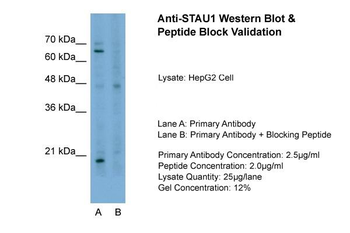 STAU1 Rabbit Polyclonal Antibody