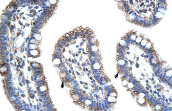 STAU1 Rabbit Polyclonal Antibody