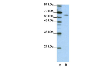 STAU1 Rabbit Polyclonal Antibody